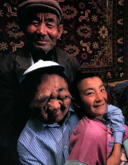 �x�[���b�N�N