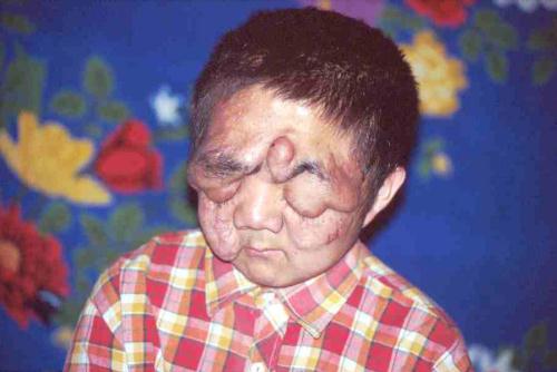 �x�[���b�N�N