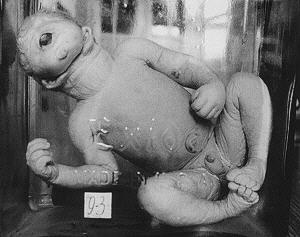 �K���X�r�̒��َ̑�